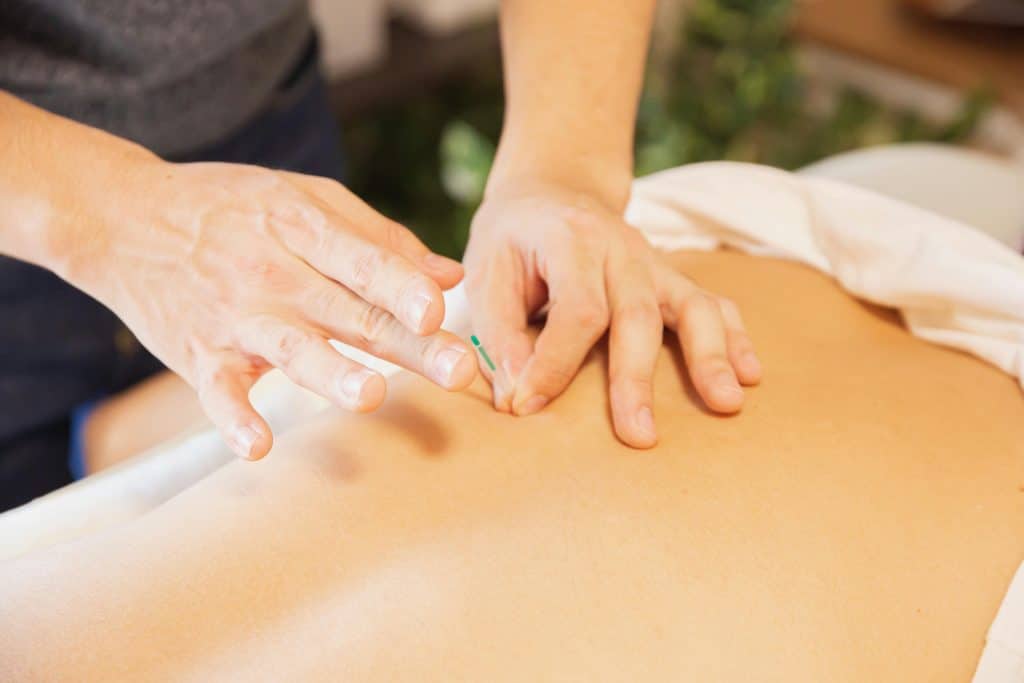 Formation d'acupuncture