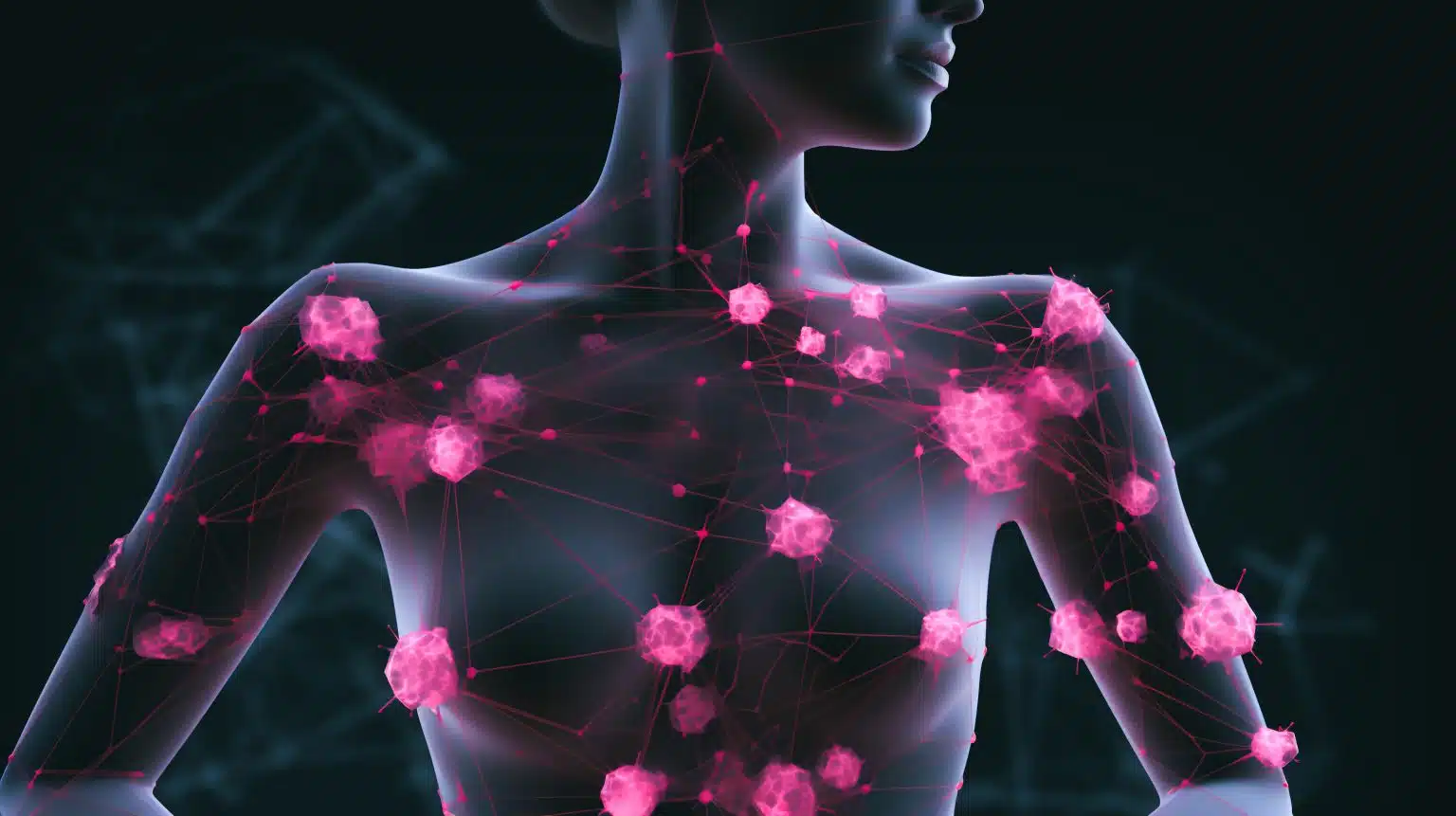 Image : Visualisez le sens littéral de la fibromyalgie, ou douleur des fibres musculaires, pour mieux comprendre cette affection aux origines mystérieuses.