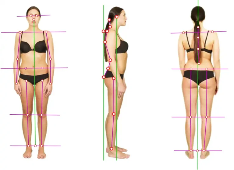 Image illustrative d'un examen de posturologie, montrant un patient effectuant des tests posturaux sous la supervision d'un praticien. La posturologie est une méthode de diagnostic et de traitement des troubles de l'équilibre postural, visant à rétablir une posture normale pour améliorer la santé globale.